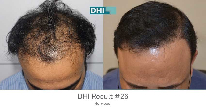 DHI - Jaipur - DHI - Jaipur