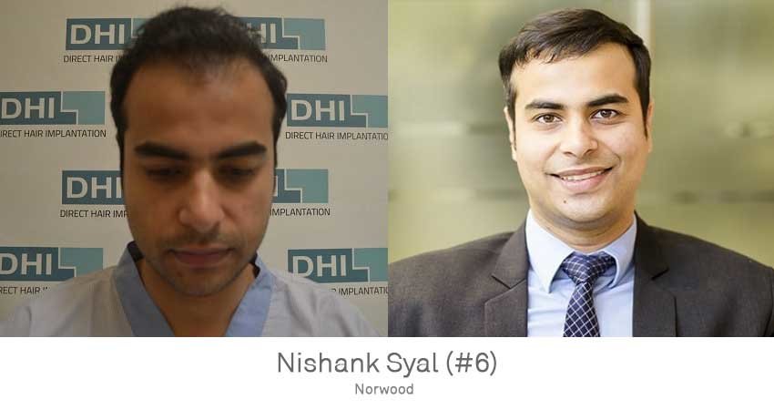 DHI - Jaipur - DHI - Jaipur