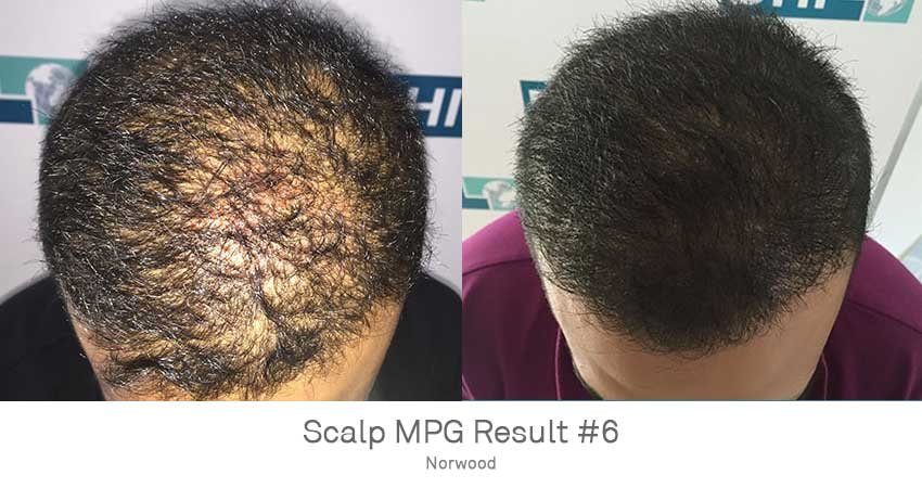 DHI - Jaipur - DHI - Jaipur