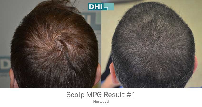 DHI - Jaipur - DHI - Jaipur