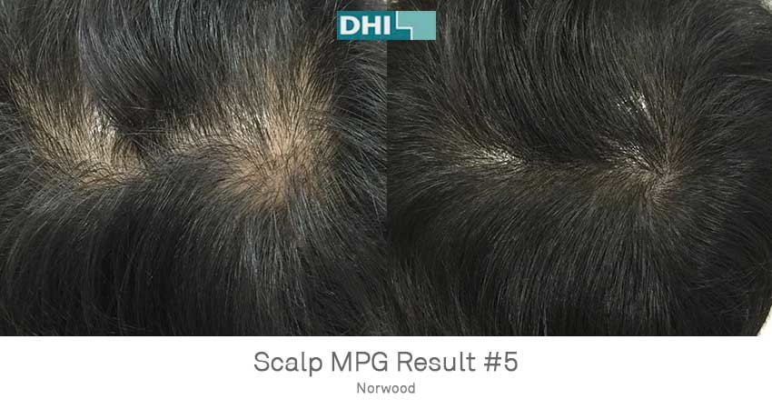 DHI - Jaipur - DHI - Jaipur