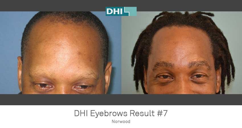 DHI - Jaipur - DHI - Jaipur