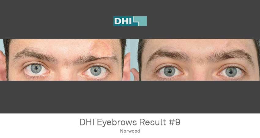 DHI - Jaipur - DHI - Jaipur