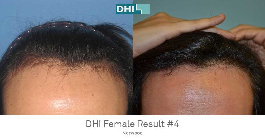 DHI - Jaipur - DHI - Jaipur