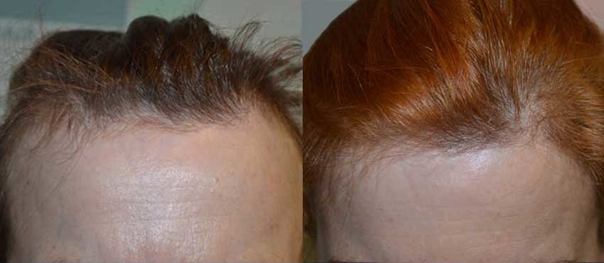 DHI - Jaipur - DHI - Jaipur