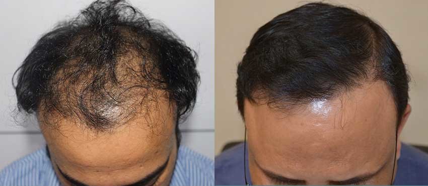 DHI - Jaipur - DHI - Jaipur