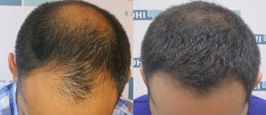 DHI - Jaipur - DHI - Jaipur