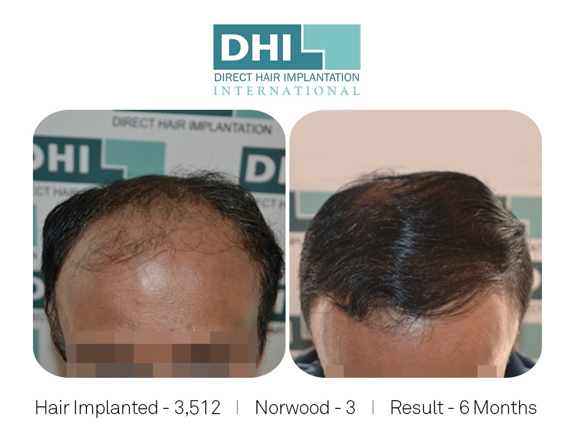 DHI - Jaipur - DHI - Jaipur