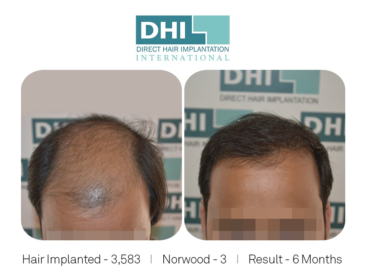 DHI - Jaipur - DHI - Jaipur