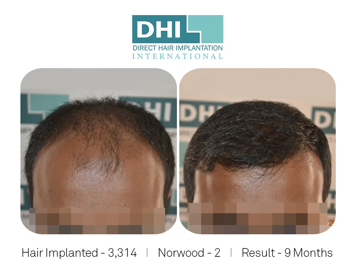 DHI - Jaipur - DHI - Jaipur