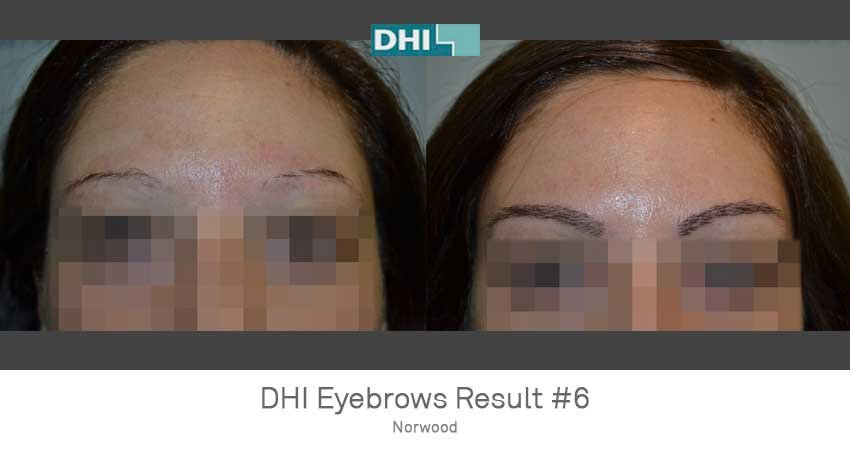 DHI-Chandigarh - DHI-Chandigarh