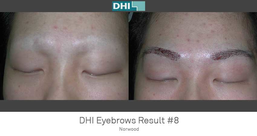 DHI-Chandigarh - DHI-Chandigarh