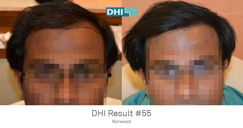 DHI-Chandigarh - DHI-Chandigarh