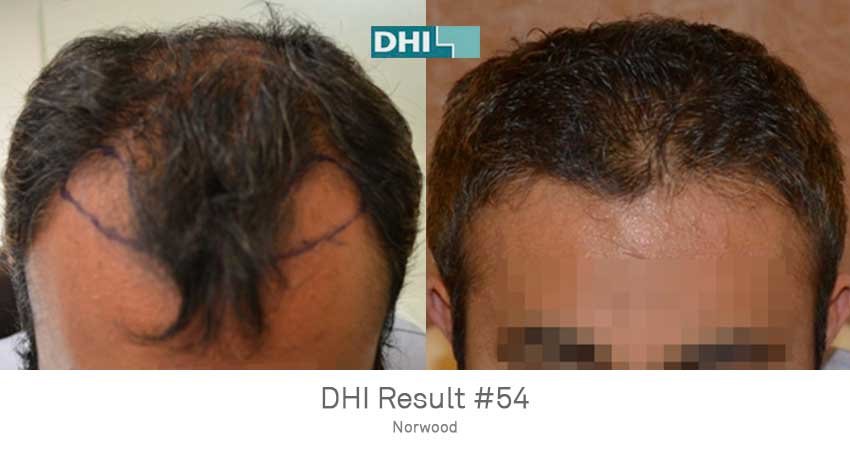 DHI-Chandigarh - DHI-Chandigarh