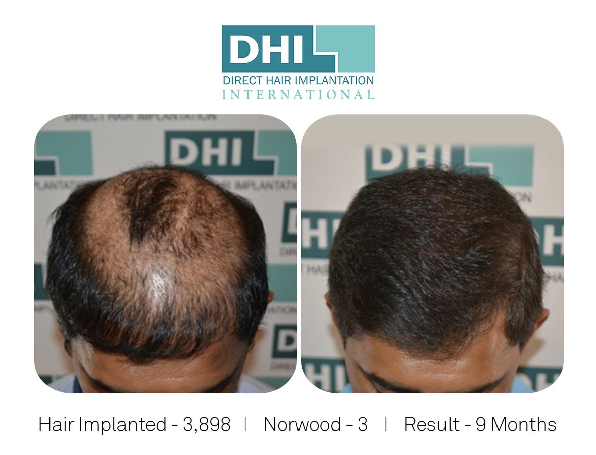 DHI-Chandigarh - DHI-Chandigarh