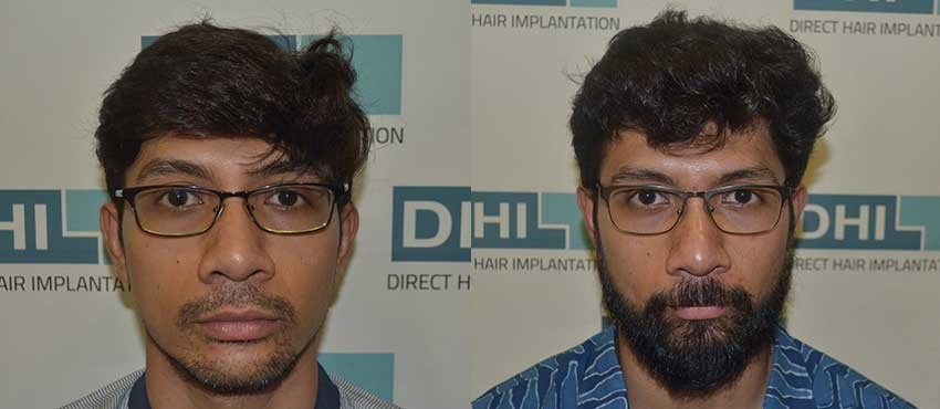DHI-Chandigarh - DHI-Chandigarh
