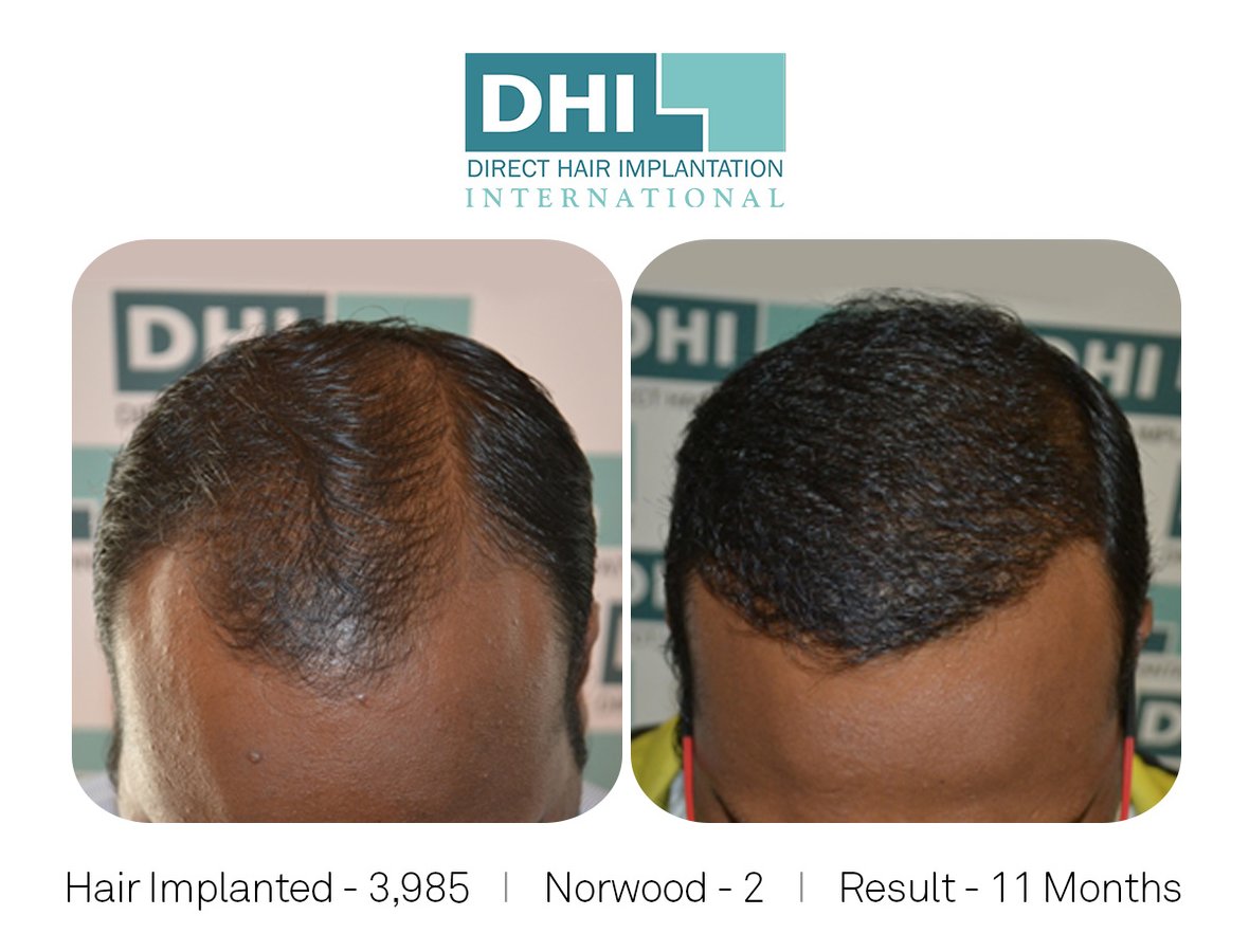 DHI-Chandigarh - DHI-Chandigarh