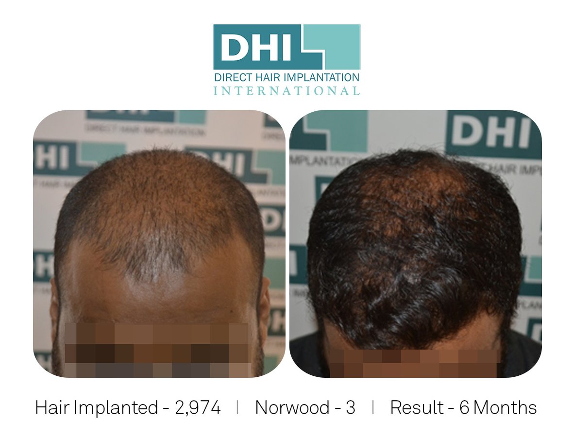 DHI-Chandigarh - DHI-Chandigarh