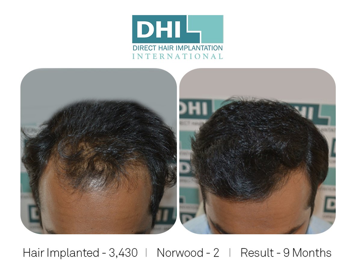 DHI-Chandigarh - DHI-Chandigarh