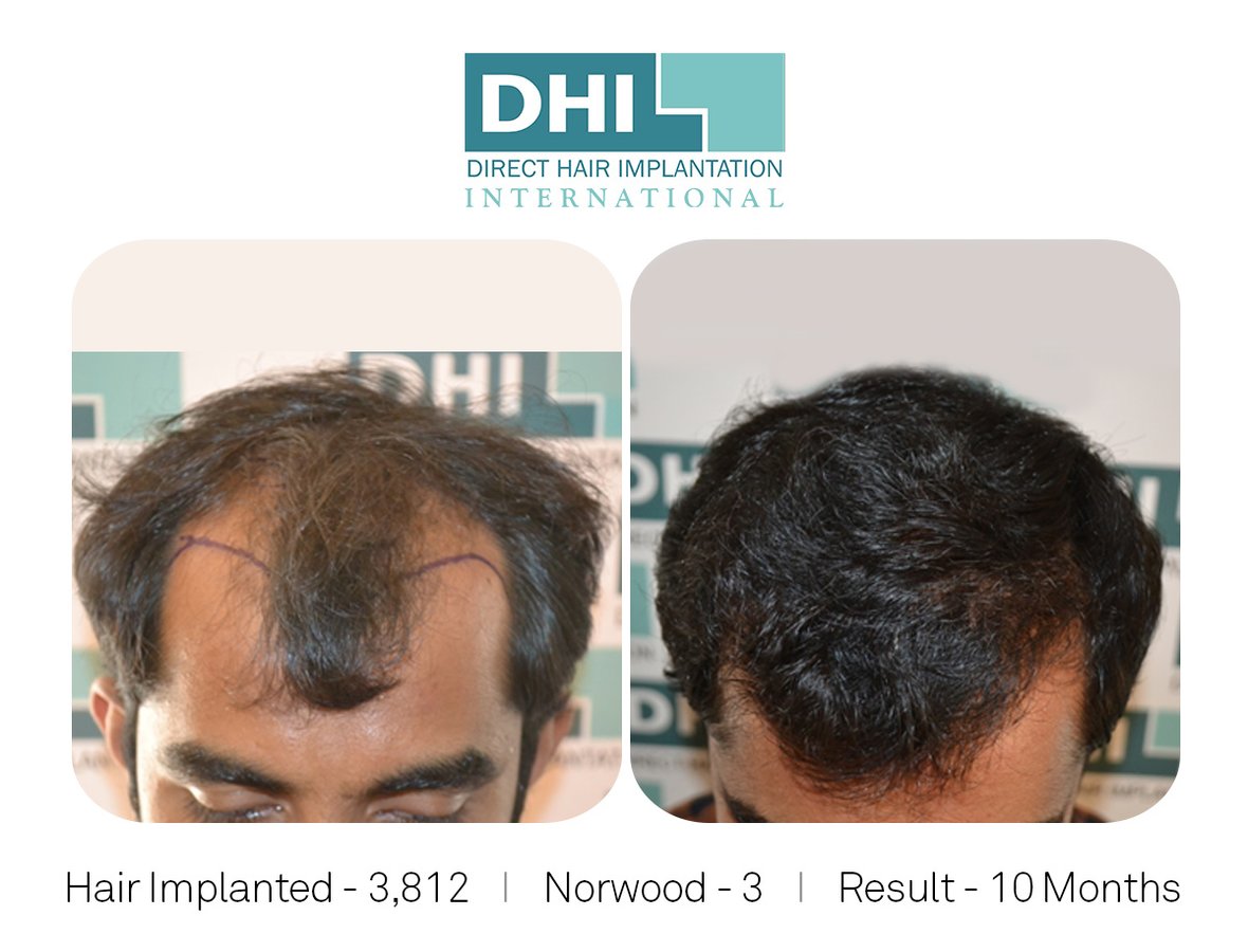 DHI-Chandigarh - DHI-Chandigarh