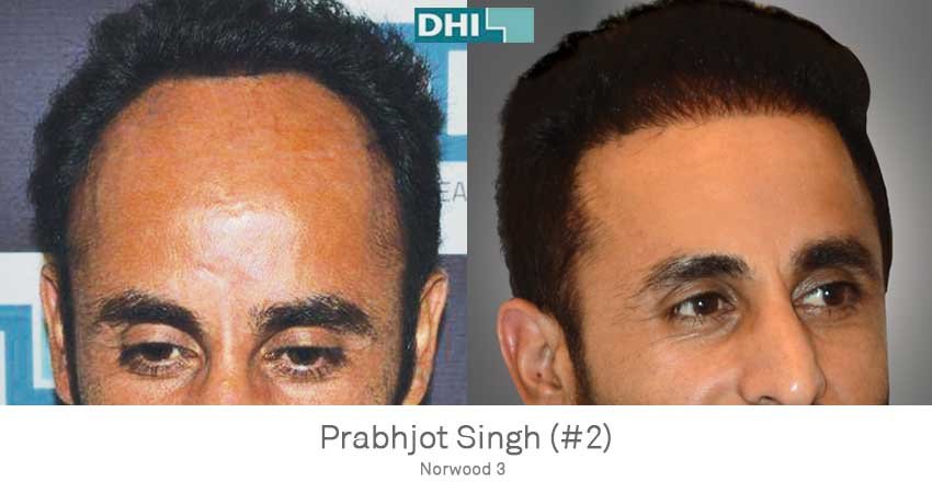 DHI-Chandigarh - DHI-Chandigarh