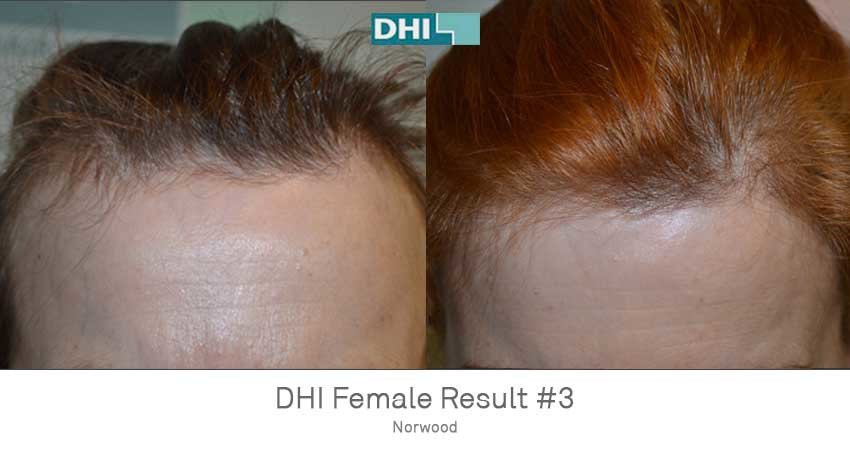 DHI-Chandigarh - DHI-Chandigarh