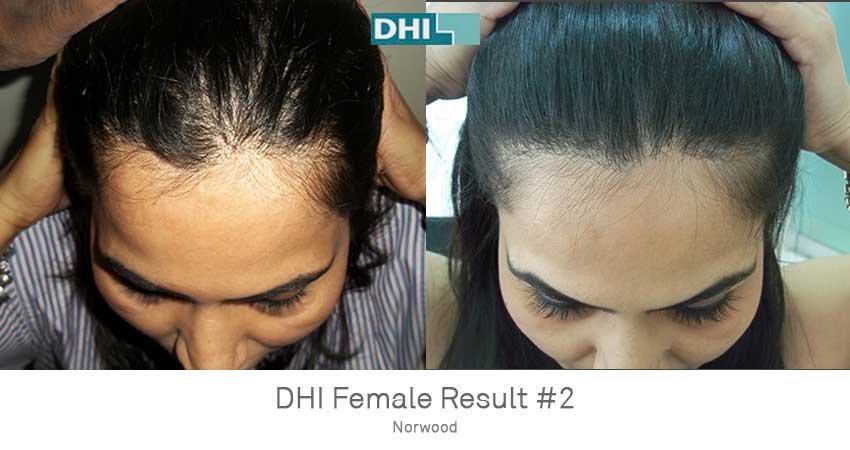 DHI-Chandigarh - DHI-Chandigarh