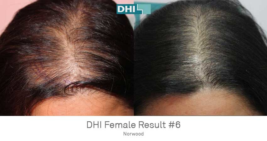 DHI-Chandigarh - DHI-Chandigarh