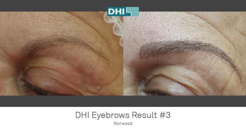 DHI-Chandigarh - DHI-Chandigarh