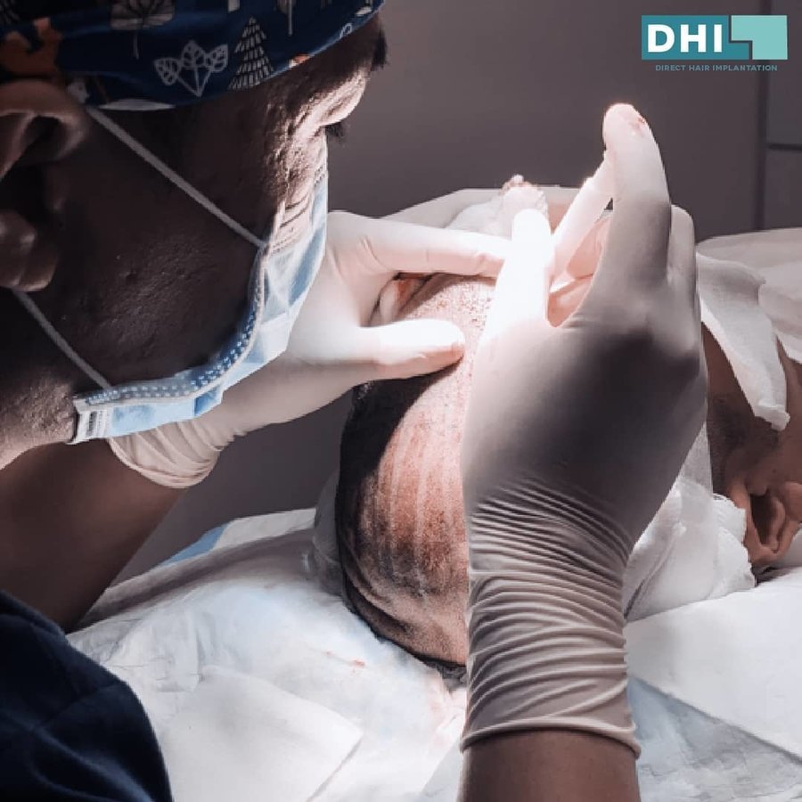 DHI-Direct Hair Implantation - DHI-Direct Hair Implantation
