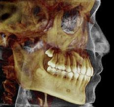 Digital Dental Radiology - Digital Dental Radiology