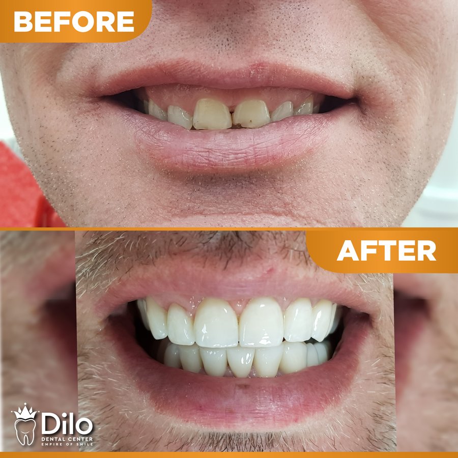 Dilo Dental Center - Dilo Dental Center