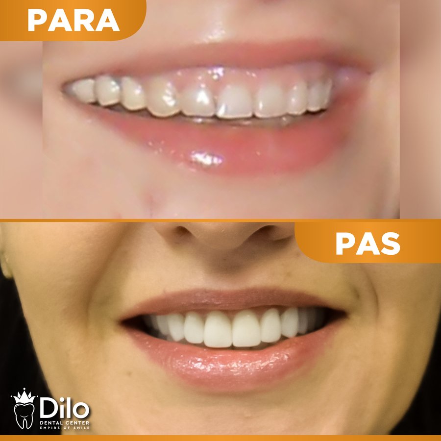 Dilo Dental Center - Dilo Dental Center