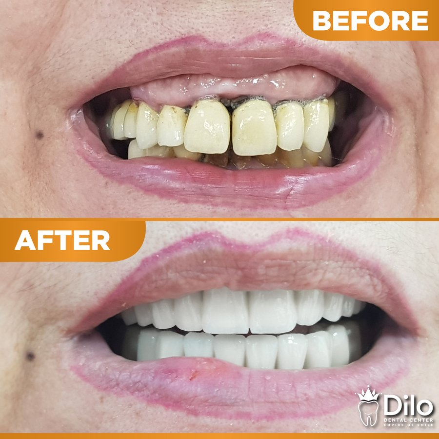 Dilo Dental Center - Dilo Dental Center