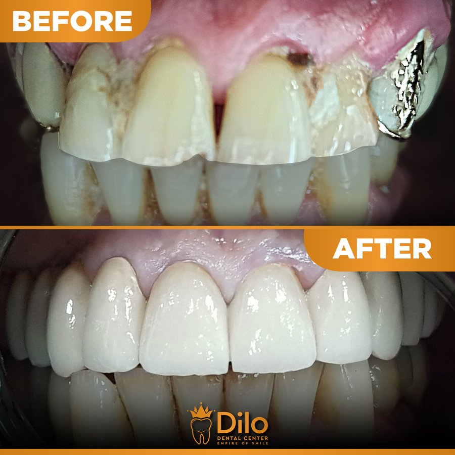 Dilo Dental Center - Dilo Dental Center