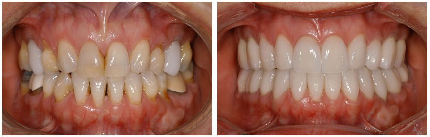 diMID Dental Implant Merida - diMID Dental Implant Merida