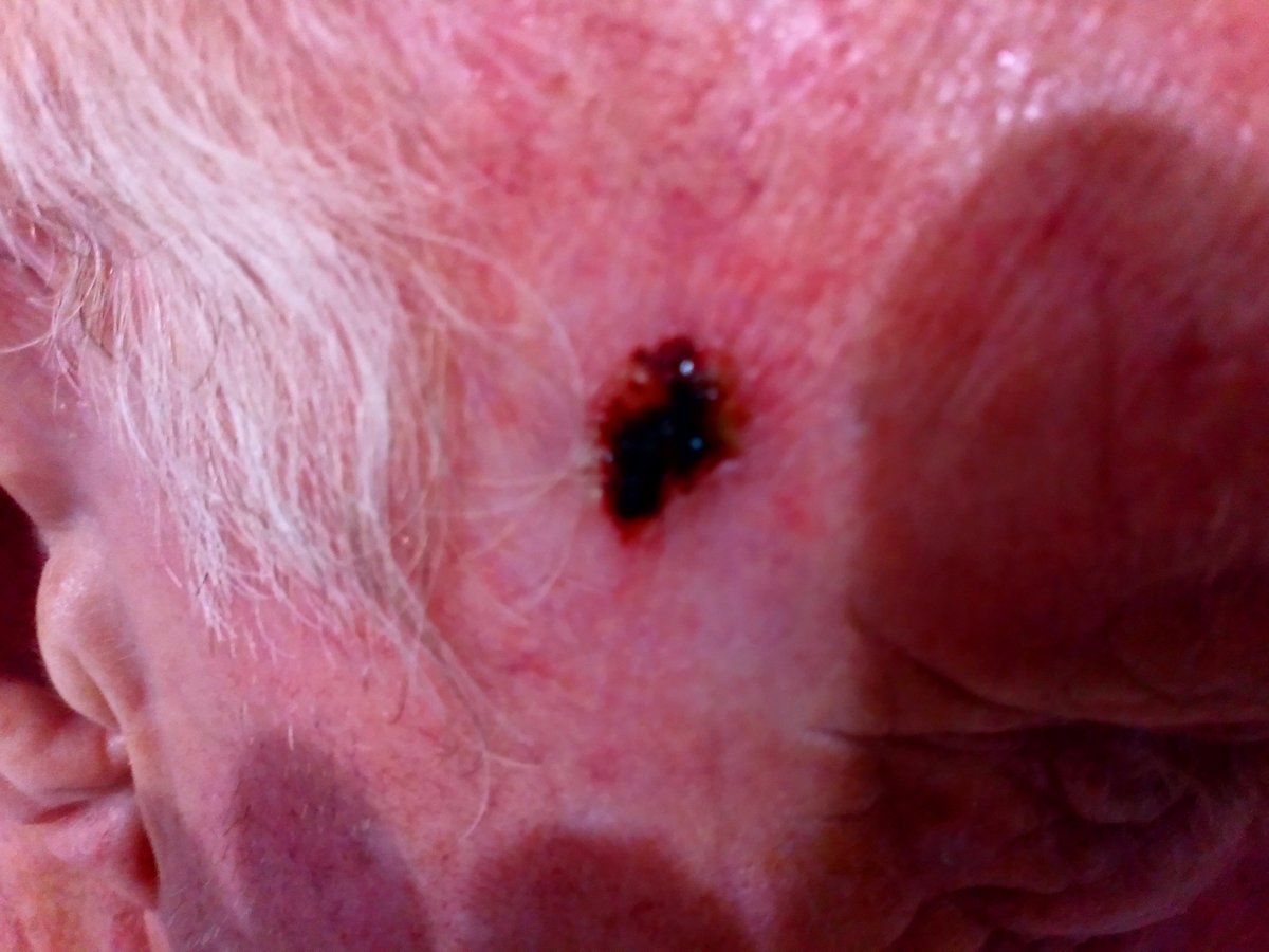 Dim-Jamora Dermatology Clinic - Makati - Dim-Jamora Dermatology Clinic - Makati