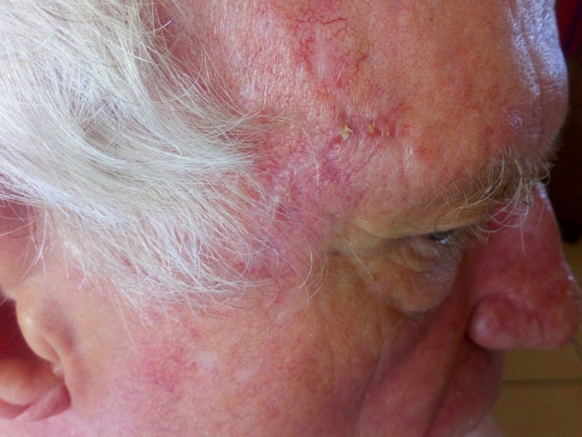 Dim-Jamora Dermatology Clinic - Makati - Dim-Jamora Dermatology Clinic - Makati