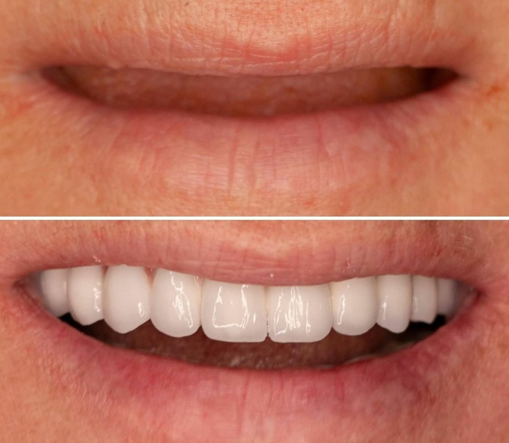 Dis 212 Dental Clinic - Ataturk Mahallesi - Dis 212 Dental Clinic - Ataturk Mahallesi