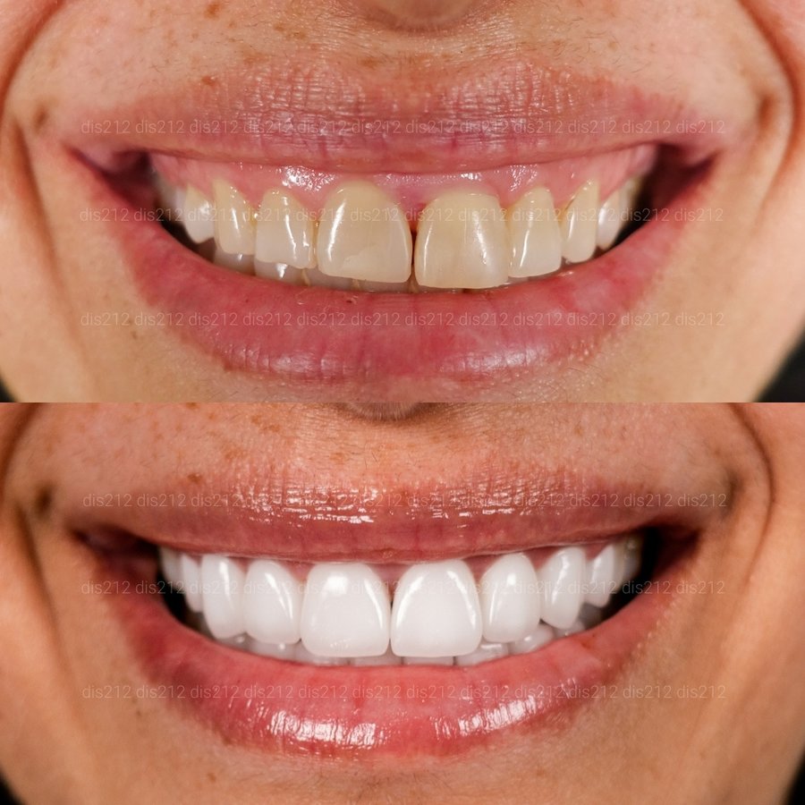 Dis 212 Dental Clinic - Ataturk Mahallesi - Dis 212 Dental Clinic - Ataturk Mahallesi