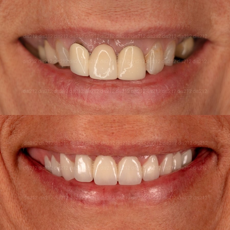 Dis 212 Dental Clinic - Ataturk Mahallesi - Dis 212 Dental Clinic - Ataturk Mahallesi