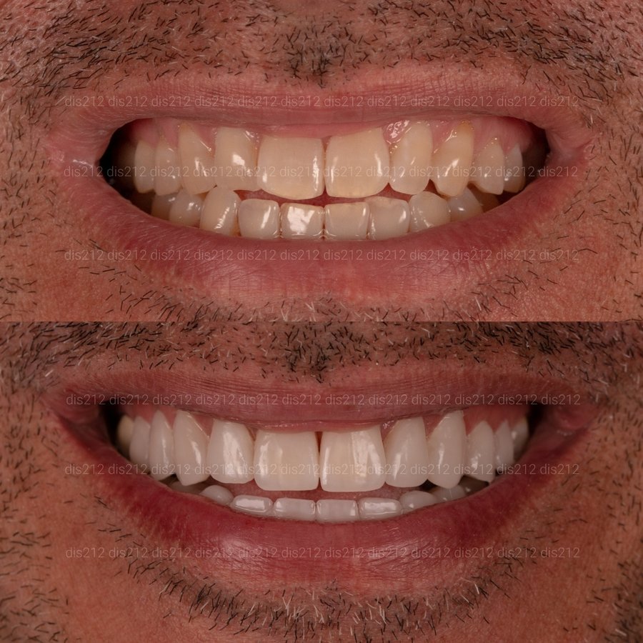 Dis 212 Dental Clinic - Ataturk Mahallesi - Dis 212 Dental Clinic - Ataturk Mahallesi