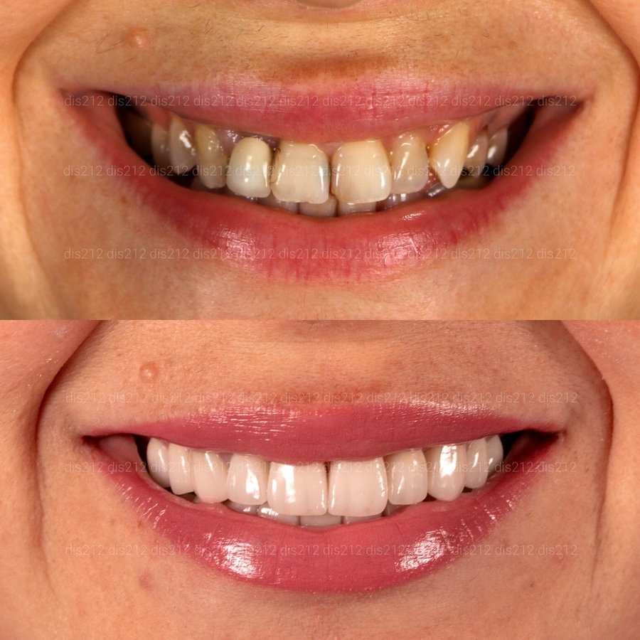 Dis 212 Dental Clinic - Ataturk Mahallesi - Dis 212 Dental Clinic - Ataturk Mahallesi