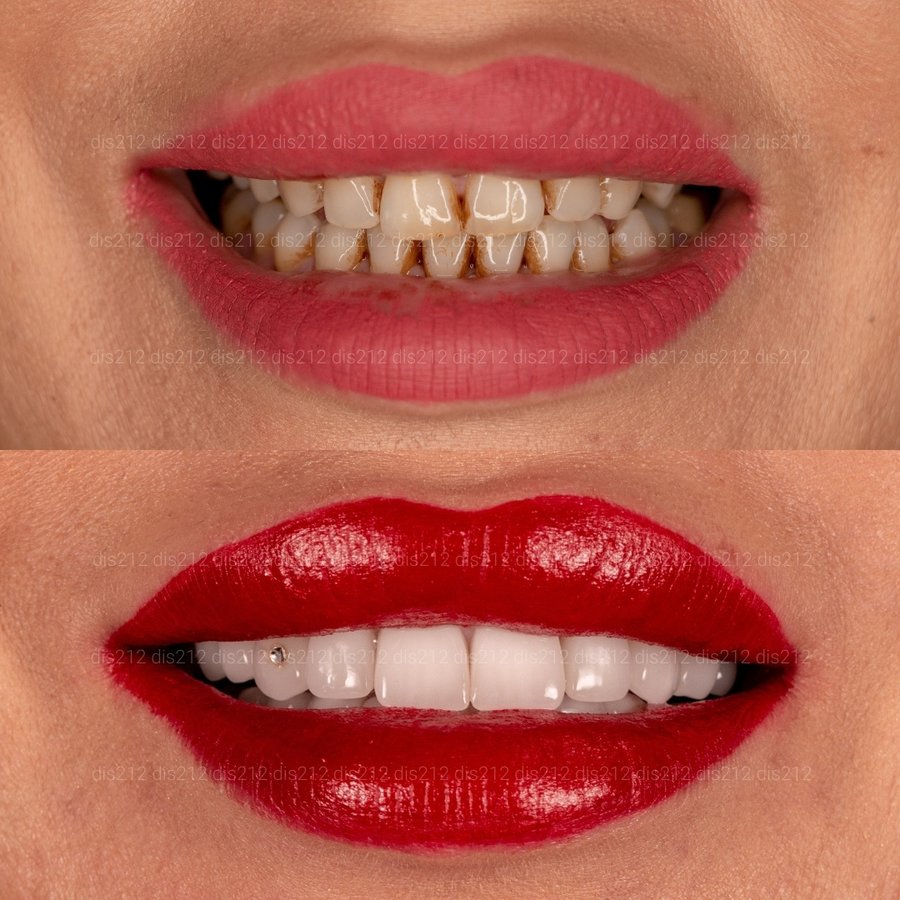 Dis 212 Dental Clinic - Ataturk Mahallesi - Dis 212 Dental Clinic - Ataturk Mahallesi