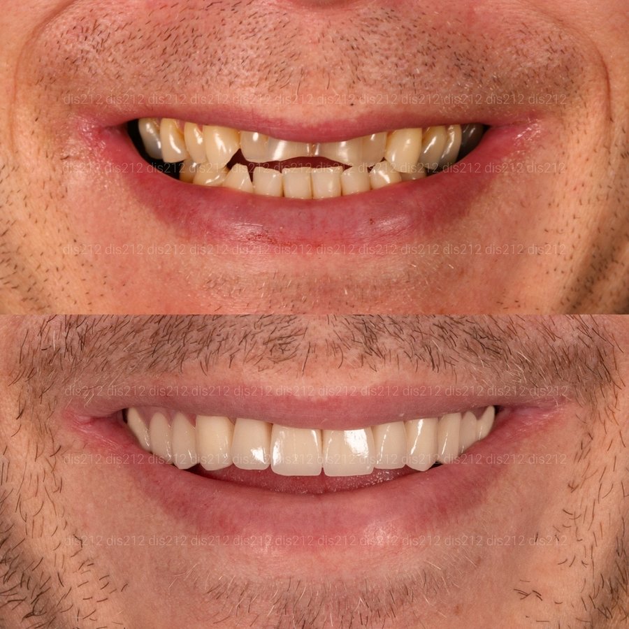 Dis 212 Dental Clinic - Ataturk Mahallesi - Dis 212 Dental Clinic - Ataturk Mahallesi