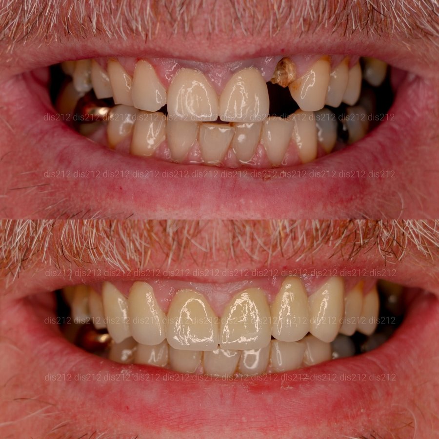 Dis 212 Dental Clinic - Ataturk Mahallesi - Dis 212 Dental Clinic - Ataturk Mahallesi