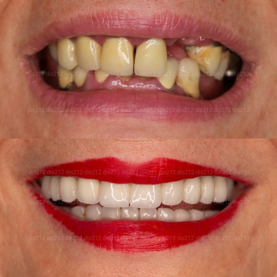 Dis 212 Dental Clinic - Ataturk Mahallesi - Dis 212 Dental Clinic - Ataturk Mahallesi