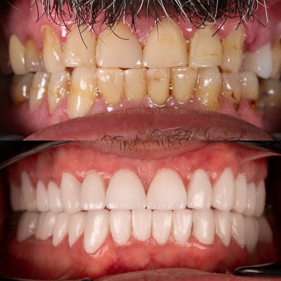 Dis 212 Dental Clinic - Ataturk Mahallesi - Dis 212 Dental Clinic - Ataturk Mahallesi