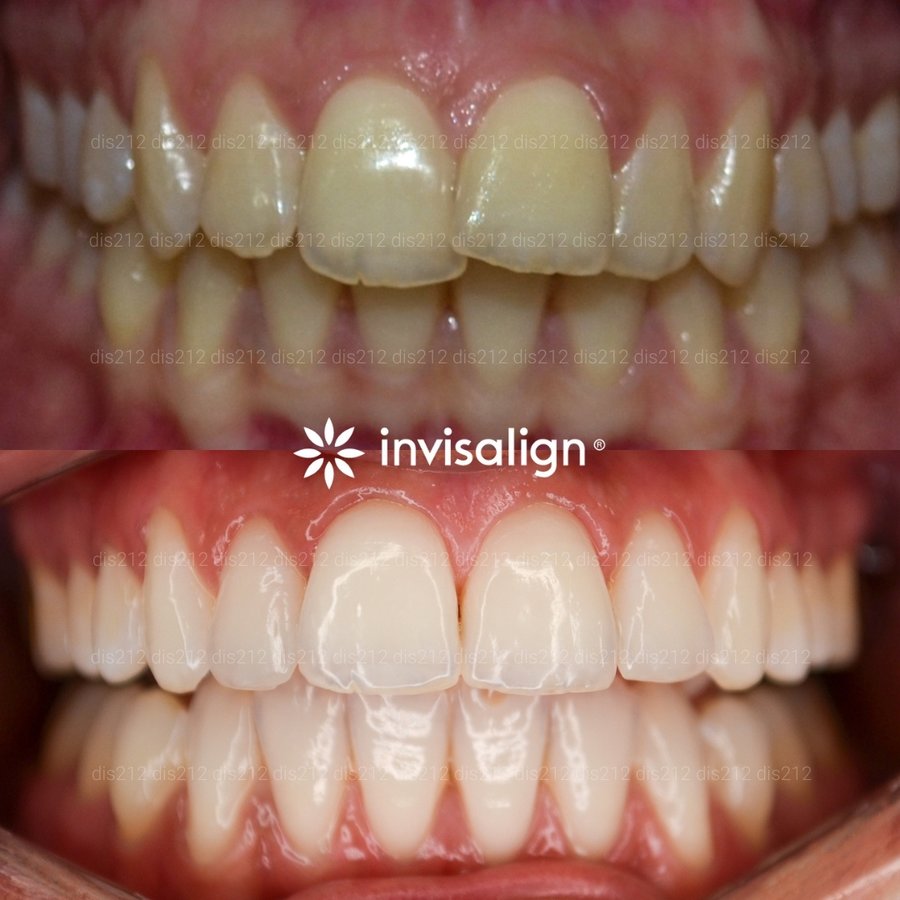 Dis 212 Dental Clinic - Ataturk Mahallesi - Dis 212 Dental Clinic - Ataturk Mahallesi