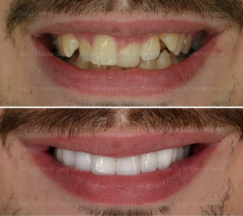 Dis 212 Dental Clinic - Ataturk Mahallesi - Dis 212 Dental Clinic - Ataturk Mahallesi